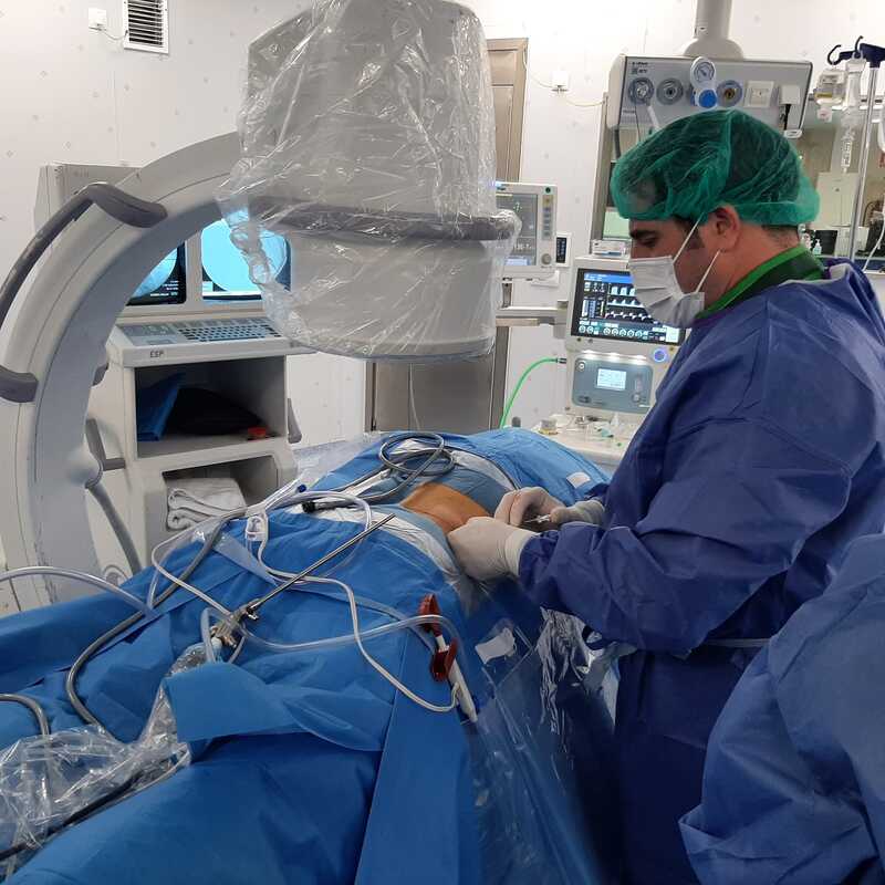 Hernia foraminal L3L4 derecha y radiculopatia L4