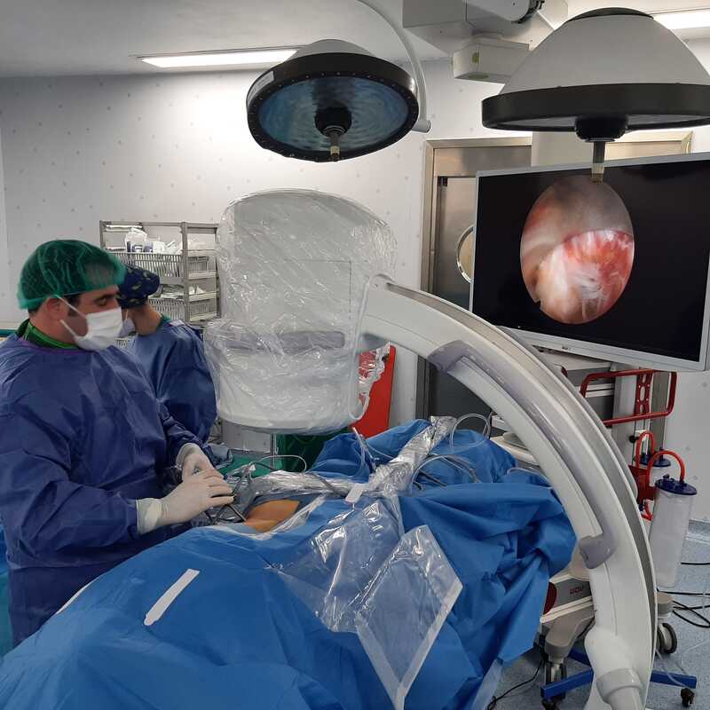 Hernia foraminal L3L4 derecha y radiculopatia L4