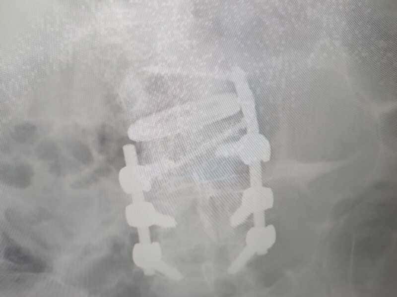 traumatologo Sevilla doctor Jose Quintana