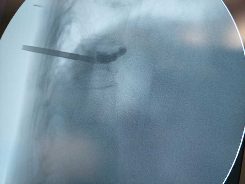 traumatologo Sevilla doctor Jose Quintana