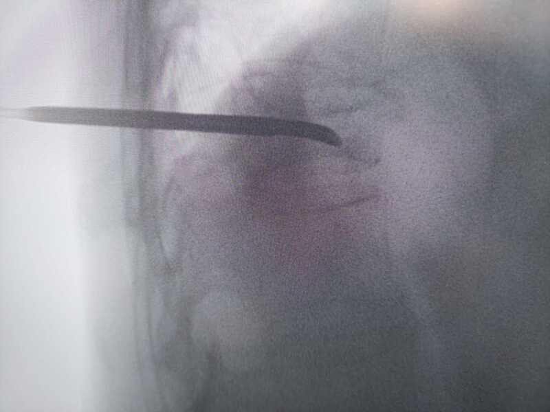 traumatologo Sevilla doctor Jose Quintana