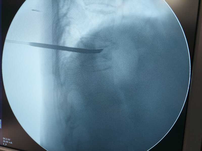 traumatologo Sevilla doctor Jose Quintana