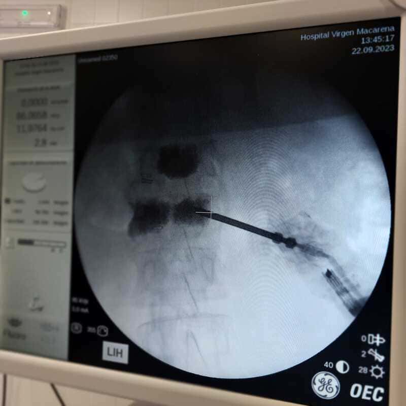 traumatologo Sevilla doctor Jose Quintana