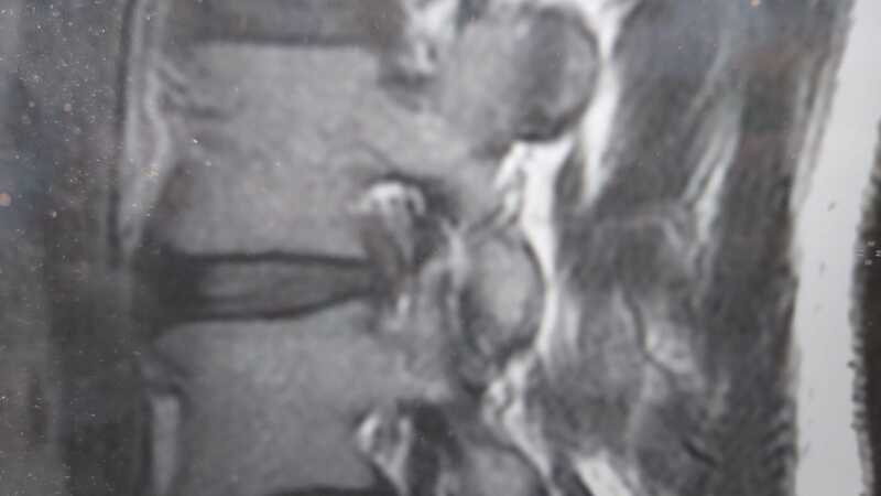 traumatologo Sevilla doctor Jose Quintana
