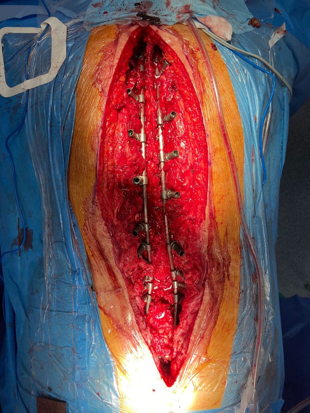 traumatologo Sevilla doctor Jose Quintana