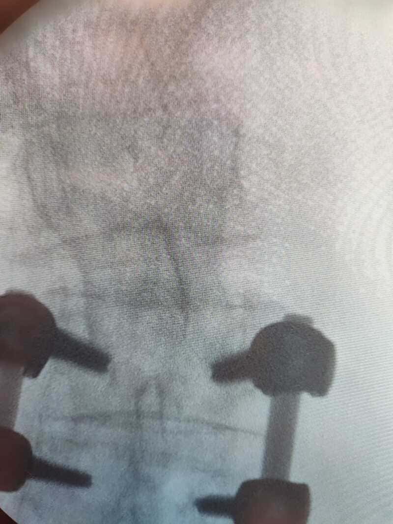 traumatologo Sevilla doctor Jose Quintana