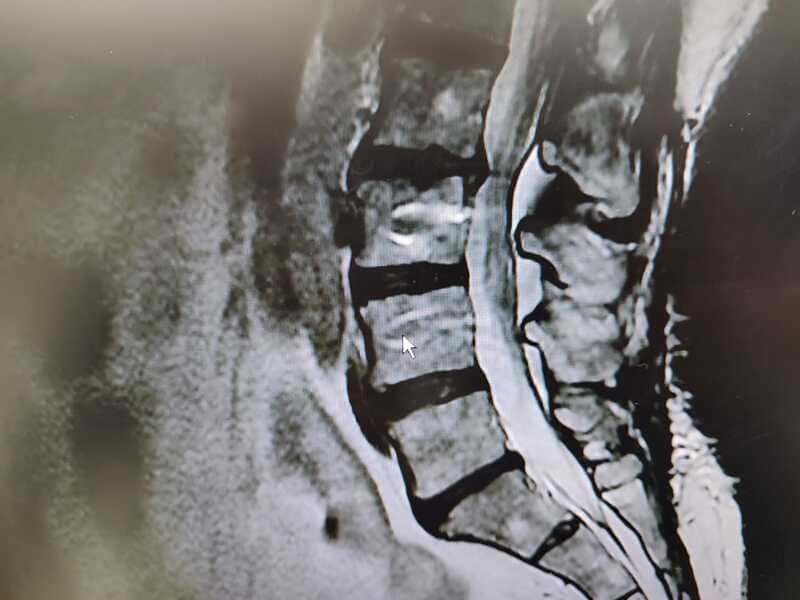 traumatologo Sevilla doctor Jose Quintana