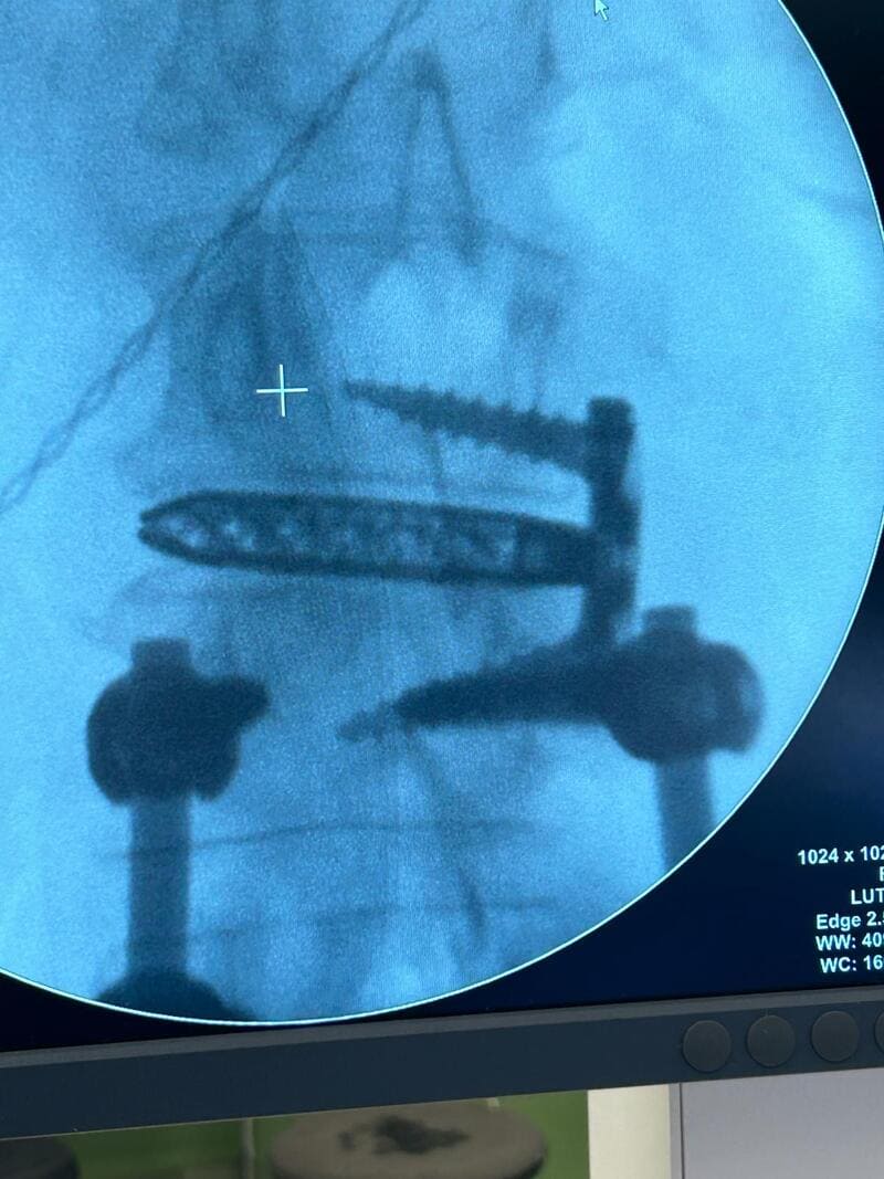 traumatologo Sevilla doctor Jose Quintana