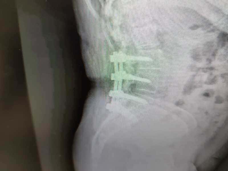traumatologo Sevilla doctor Jose Quintana
