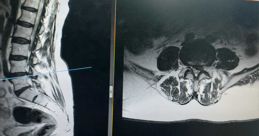 traumatologo Sevilla doctor Jose Quintana
