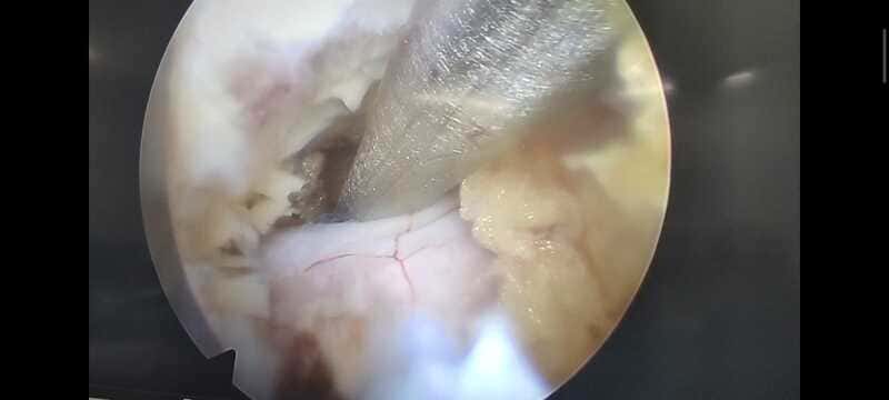 traumatologo Sevilla doctor Jose Quintana