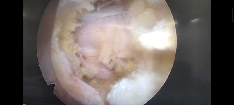 traumatologo Sevilla doctor Jose Quintana