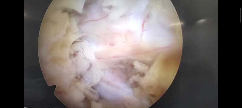 traumatologo Sevilla doctor Jose Quintana