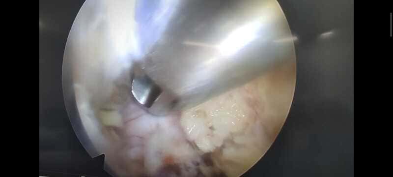 traumatologo Sevilla doctor Jose Quintana