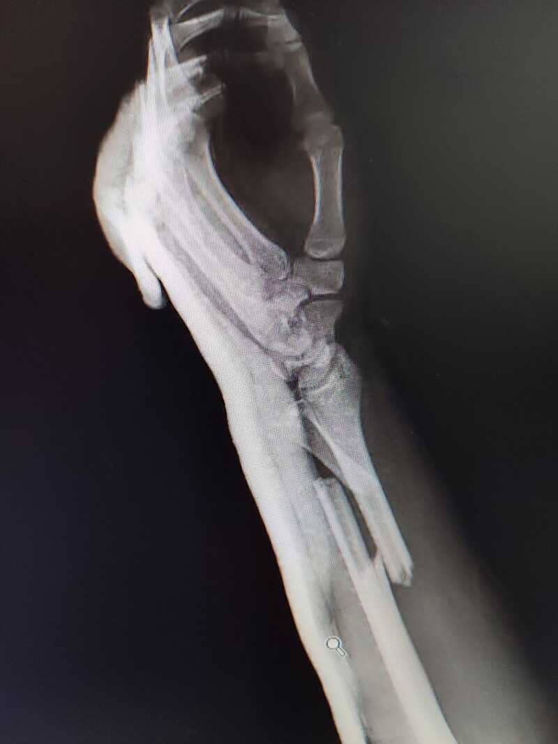 traumatologo Sevilla doctor Jose Quintana