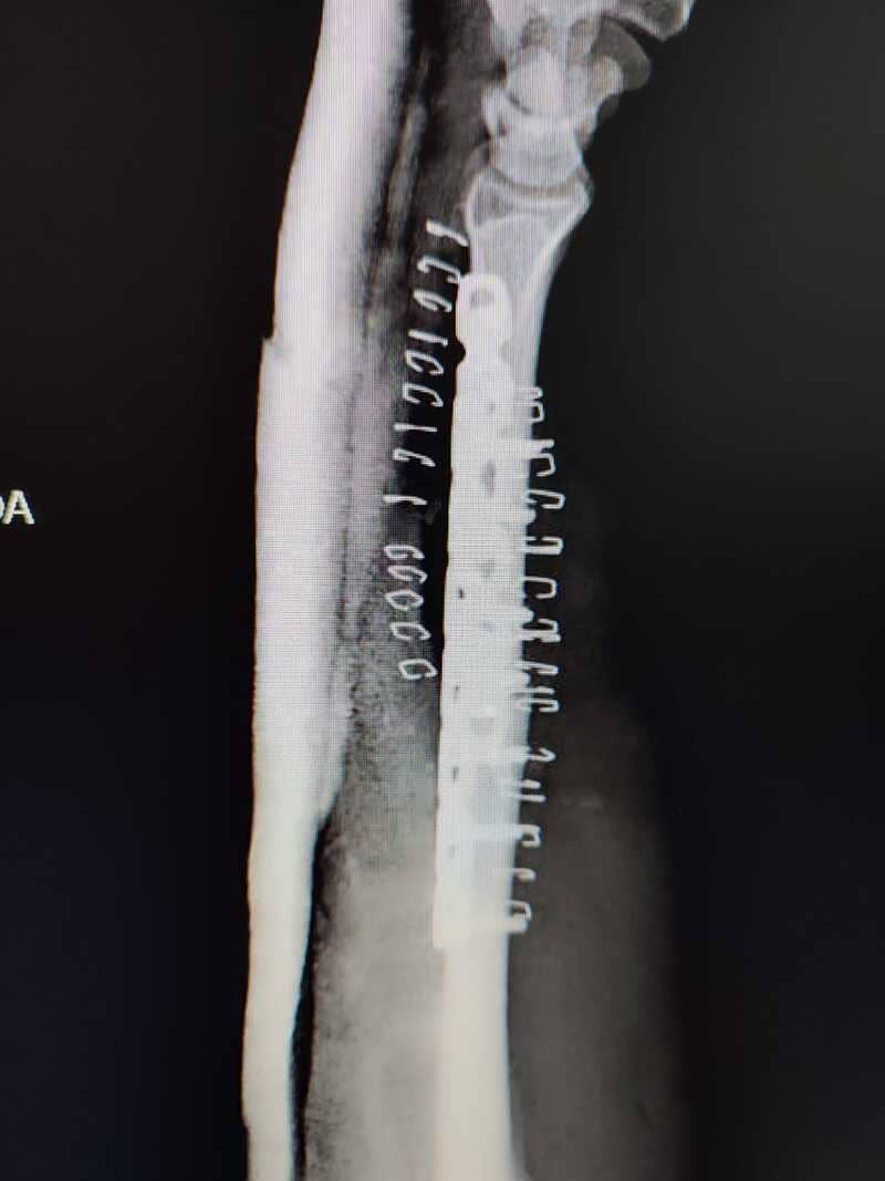 traumatologo Sevilla doctor Jose Quintana