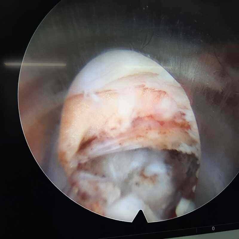 traumatologo Sevilla doctor Jose Quintana