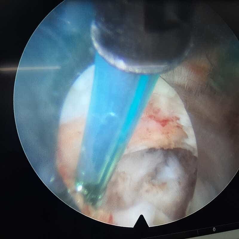 traumatologo Sevilla doctor Jose Quintana