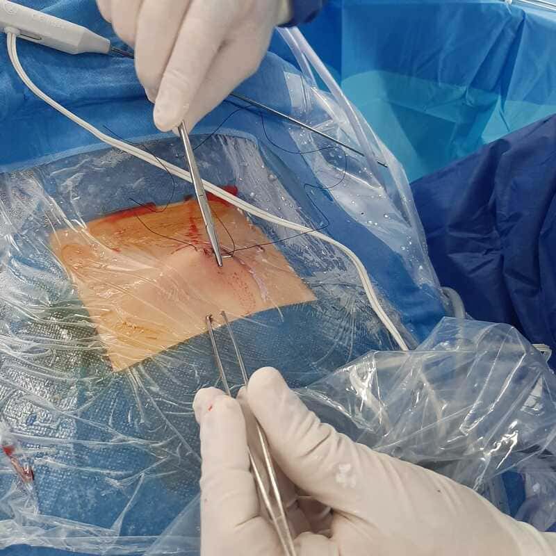 traumatologo Sevilla doctor Jose Quintana