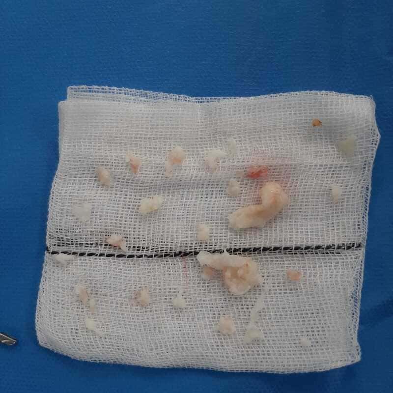 traumatologo Sevilla doctor Jose Quintana