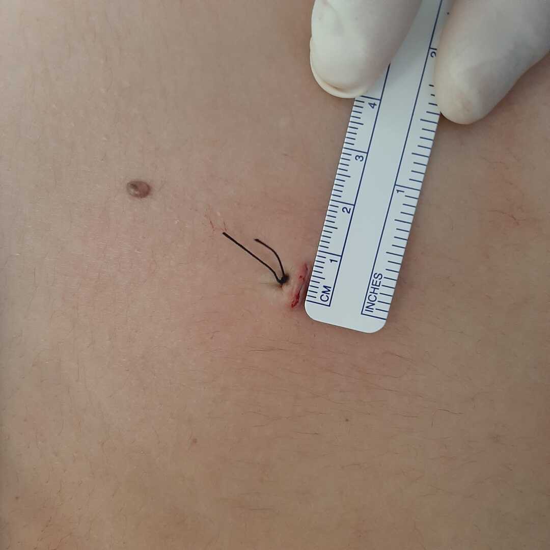 traumatologo Sevilla doctor Jose Quintana