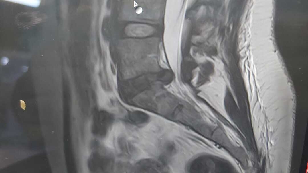 traumatologo Sevilla doctor Jose Quintana